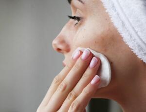 ¿Cómo afecta el sol al acné durante el verano?