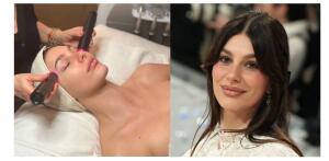 LYMA, el láser de las celebrities para lucir piel perfecta