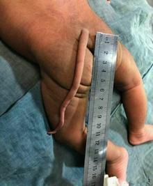 Resultado de imagen de cola vestigial